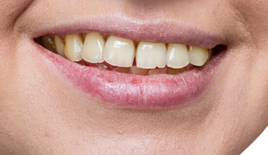 Before - Hope Dental